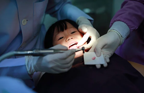 dental-extraction