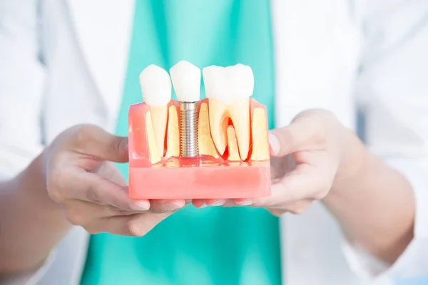 dentist-with-implant
